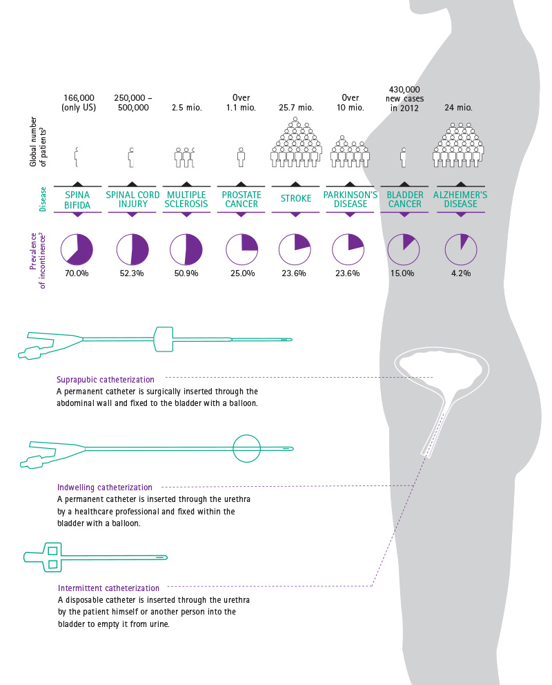 Urinary Catheterization Methods of Bladder Empyting